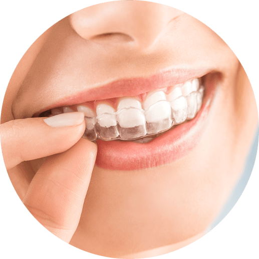 mouthguard