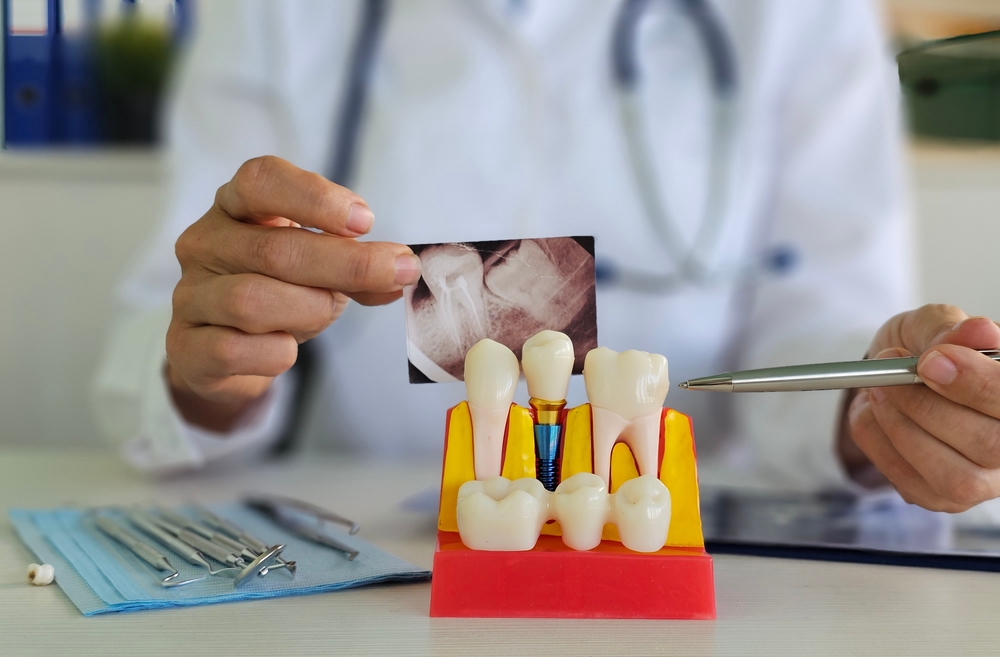 Image of a dentist explaining the dental implant process step by step to a patient, using a digital screen to display 3D scans and implant placement. No text on image.